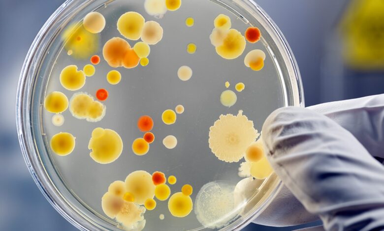 Bacteria listeria